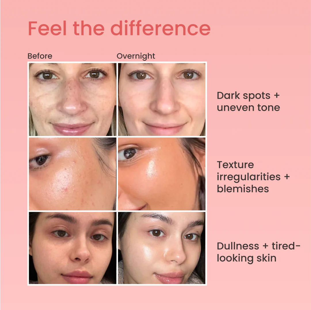 Overnight Skin Reset™