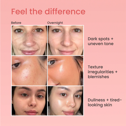 Overnight Skin Reset™