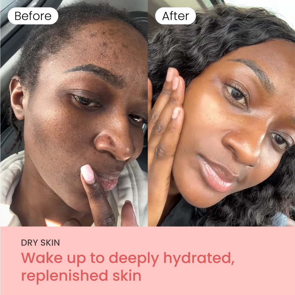 Overnight Skin Reset™