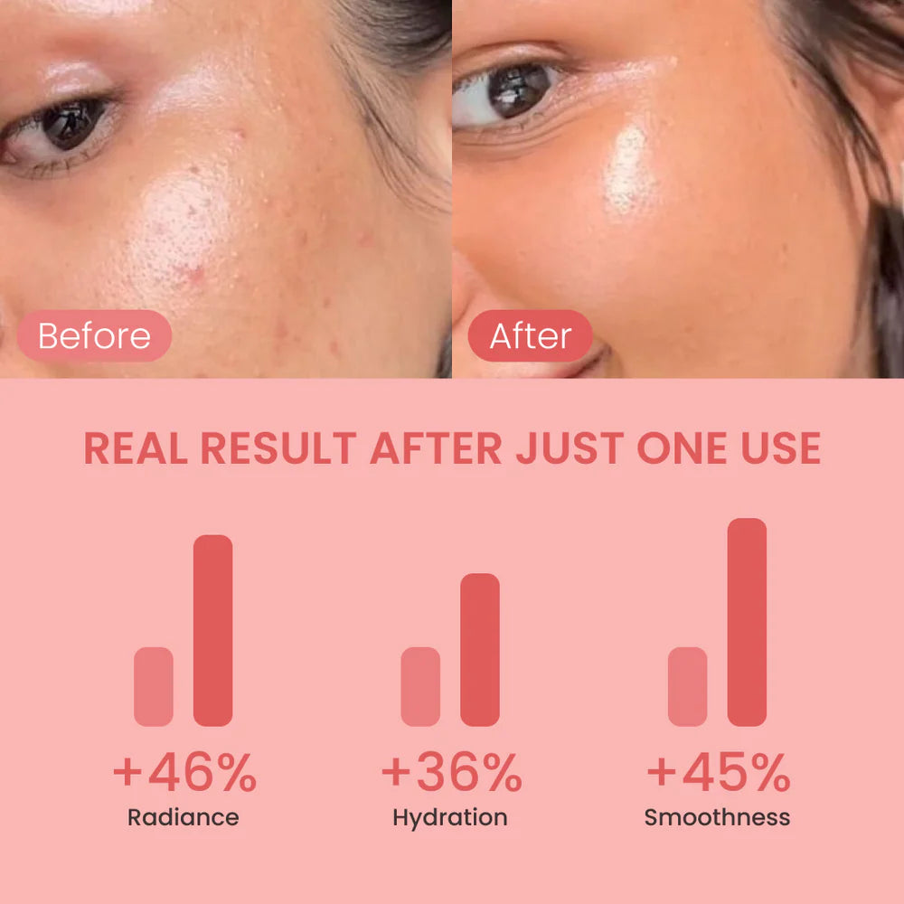 Overnight Skin Reset™
